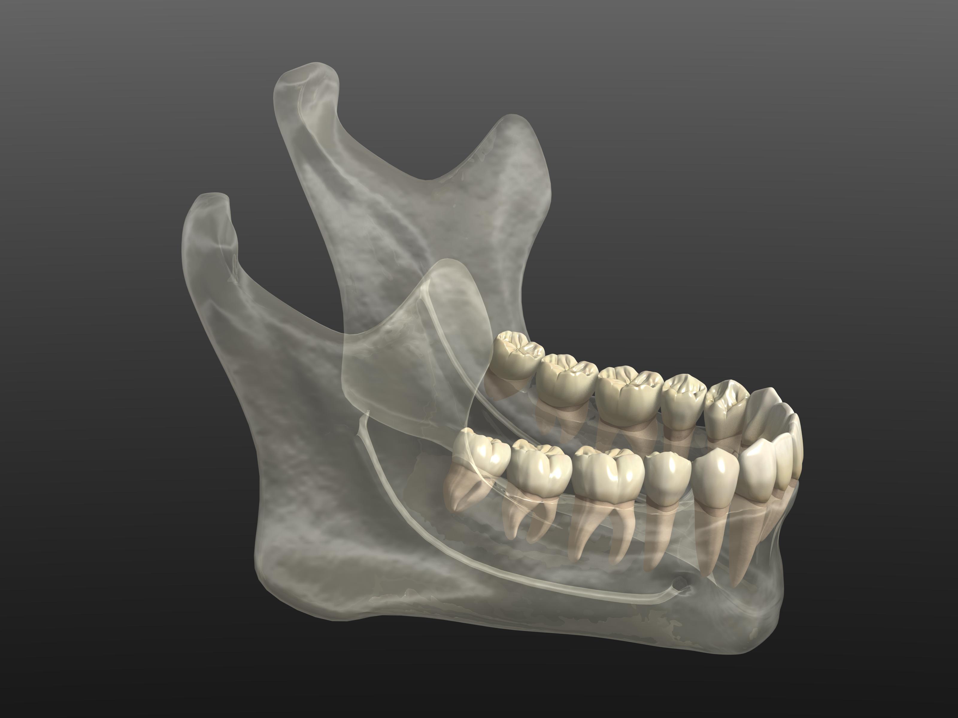 Corrective Jaw Utah Oral Surgery & Dental Implant Center